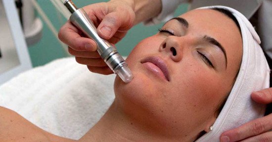 microdermabrasion where to get it done